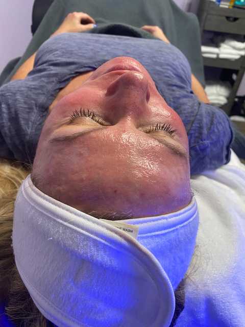 gallery image in our gallery