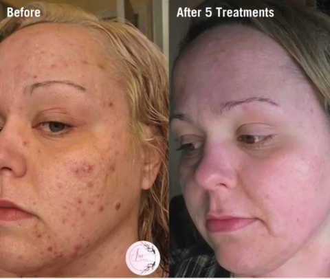 gallery image in our gallery