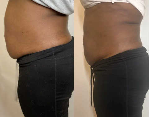 gallery image in our gallery