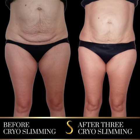 gallery image in our gallery