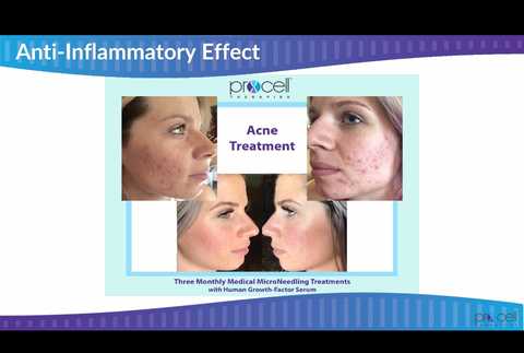 gallery image in our gallery