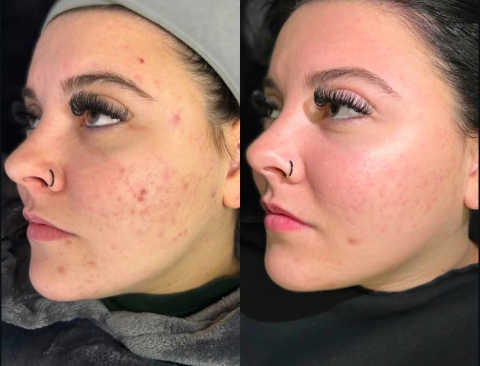 gallery image in our gallery