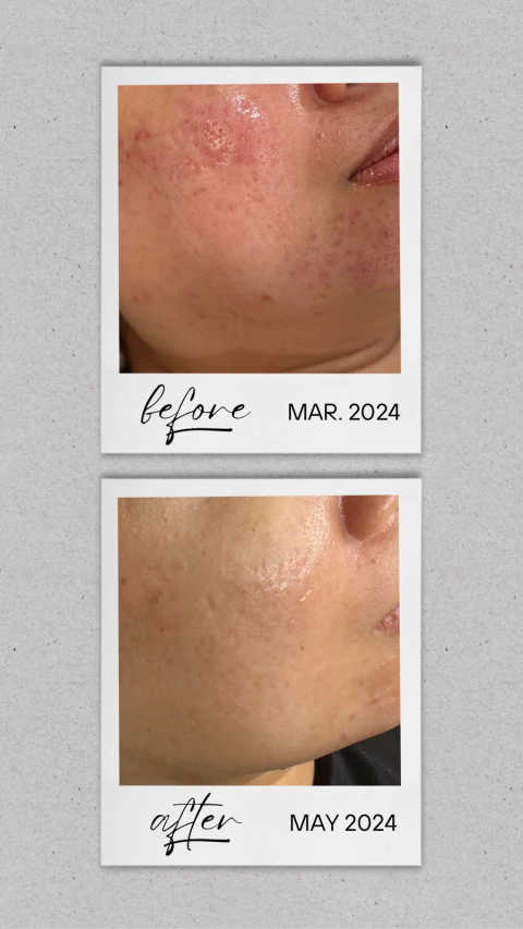 gallery image in our gallery