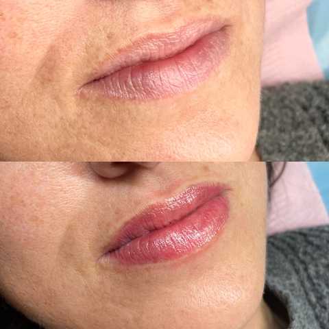 gallery image in our gallery