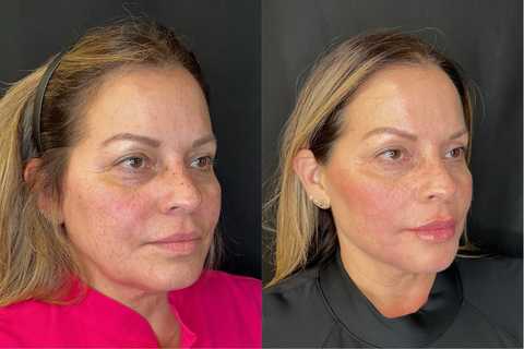 gallery image in our gallery