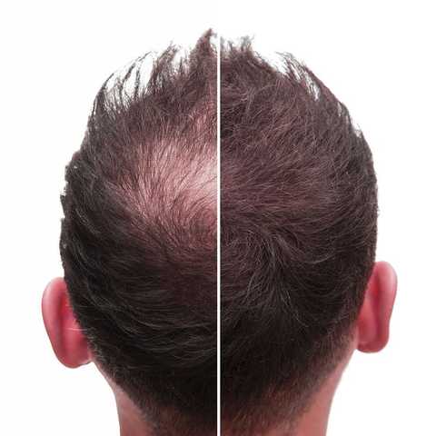 Hair & Scalp Analysis Follicle Discovery