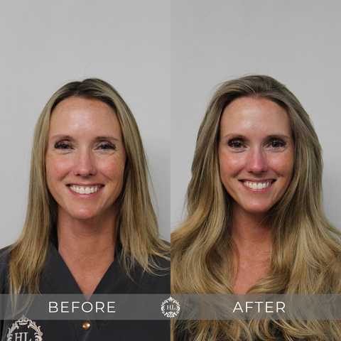 gallery image in our gallery