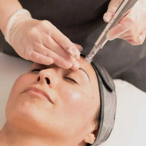 BioRePeel Treatments service