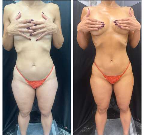 gallery image in our gallery