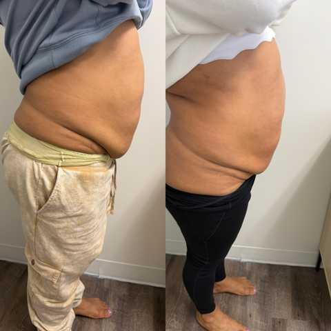 gallery image in our gallery