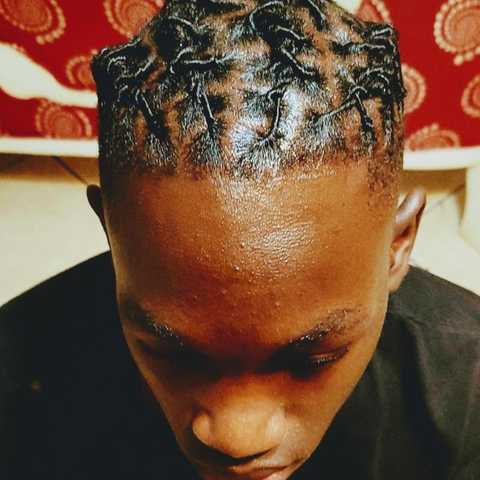 Loc Coils