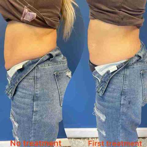 gallery image in our gallery