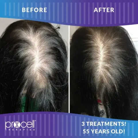 Hair restoration  service