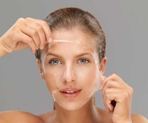 Chemical Peels service