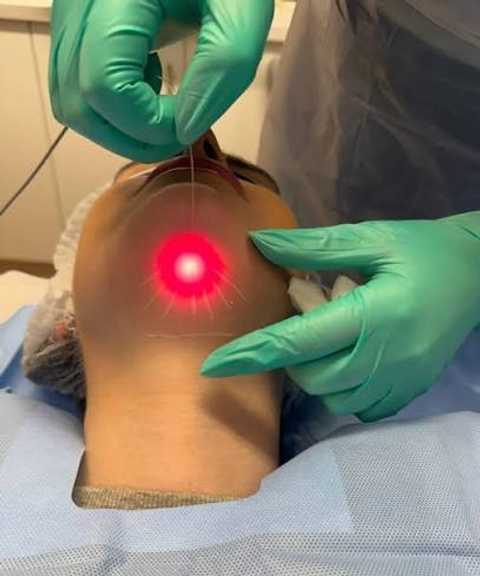 Laser Treatments service