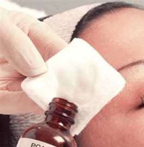 Chemical Peel