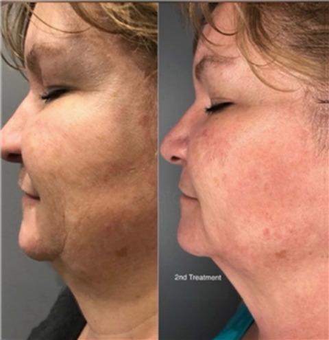 gallery image in our gallery