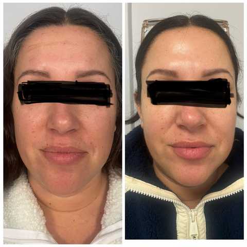 gallery image in our gallery