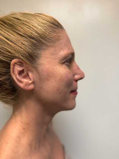 gallery image in our gallery