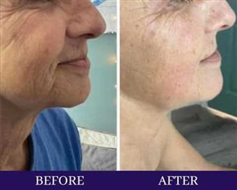 gallery image in our gallery