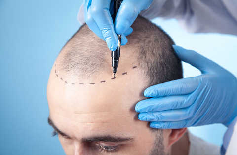 Advanced Hair & Scalp Analysis Follicle Wellness Precision
