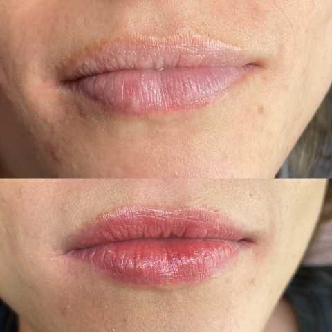 gallery image in our gallery