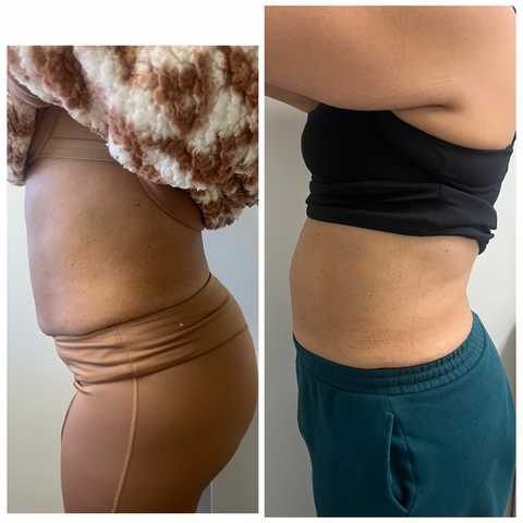 gallery image in our gallery