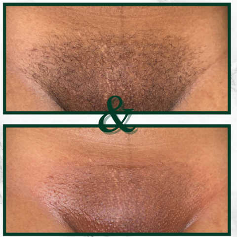 gallery image in our gallery