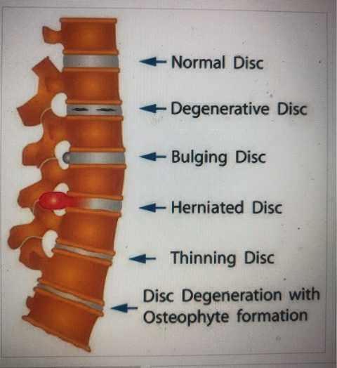 gallery image in our gallery