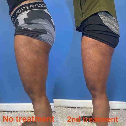 gallery image in our gallery