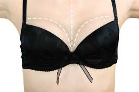 Breast Fat Grafting Beverly Hills CA: Benefits, Procedure, and Recovery