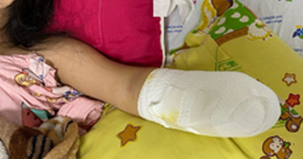 Nguy hại của việc trẻ em chơi đùa với pháo hoa