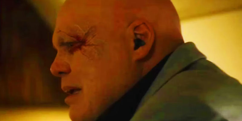 Kingpin showing off his bullet wound in Echo episode 4 - The Convergence of Fates