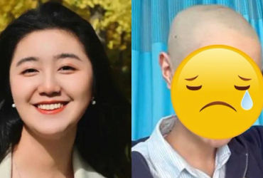 Hành trình chiến đấu của ngôi sao nhí với bệnh u não hiếm gặp