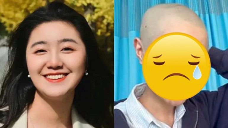 Hành trình chiến đấu của ngôi sao nhí với bệnh u não hiếm gặp