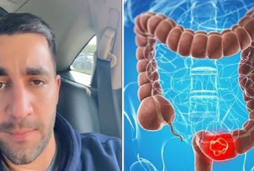 Khám Phá Những Dấu Hiệu Cảnh Báo Ung Thư Đại Trực Tràng Bạn Có Thể Đã Bỏ Qua