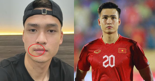 Vết Rách Môi của Bùi Hoàng Việt Anh: Sự Kiên Cường và Phong Độ Không Hề Sụt Giảm