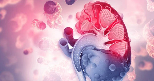 Nhận biết Ung Thư Thận: Bí Ẩn và 3 Dấu Hiệu Quan Trọng