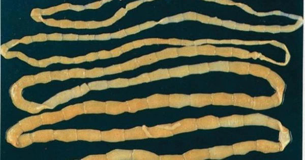 Sự Kỳ Diệu và Nguy Hiểm của Sán Dây Trong Cơ Thể Người