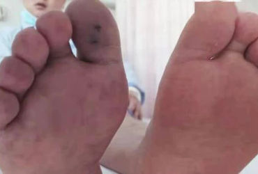 Những Sự Thật Không Ngờ Về Hút Thuốc Lá Mà Bạn Cần Biết