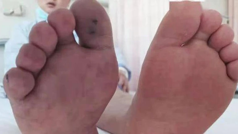 Những Sự Thật Không Ngờ Về Hút Thuốc Lá Mà Bạn Cần Biết