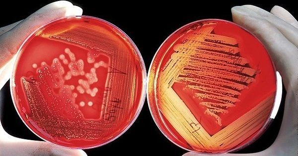 Tận hưởng cảm giác tự tin tuyệt đỉnh! 7 nguyên nhân gây mùi hôi vùng kín và bí quyết loại bỏ