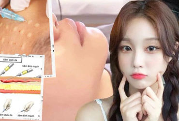 Tại sao việc tiêm meso trong thẩm mỹ nội khoa đang trở thành cơn sốt? Bác sĩ da liễu sẽ giải đáp!