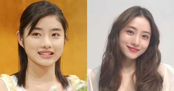 Bí quyết đơn giản để có khuôn mặt thon gọn và gương mặt cân đối