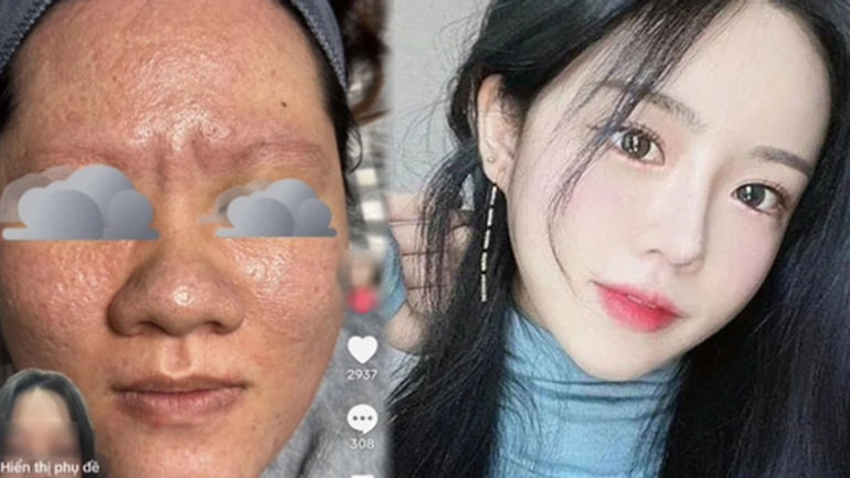 Uống L-cystine và biotin liệu có thật sự làm da dày sừng hơn? Bác sĩ da liễu tiết lộ những điều ít người biết