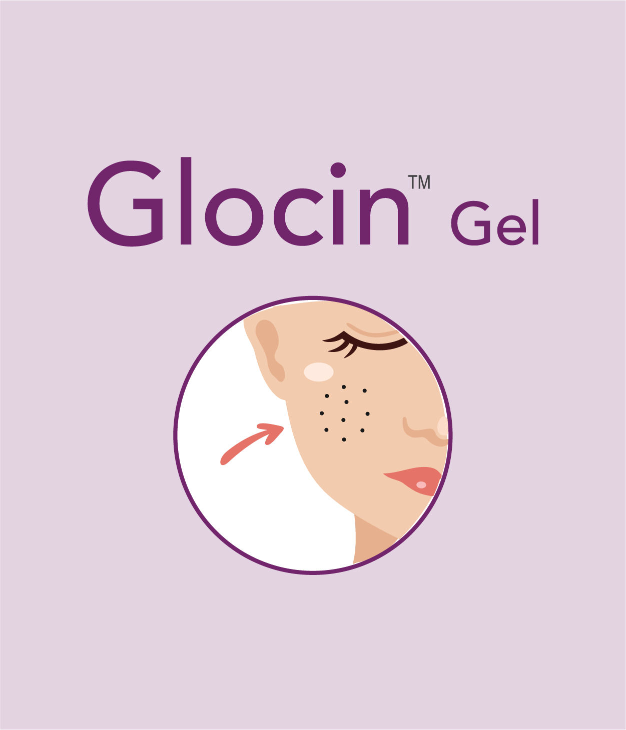 Glocin Gel Acne Care Tips Thumbnail for Glocin Gel Acne Care Tips