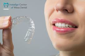 https://invisaligncentersandiego.com/wp-content/uploads/2017/05/invisalign-slide1-1366x768.jpg