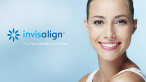 Invisalign Dentist San Diego