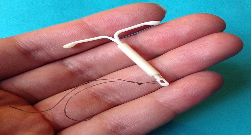 Intrauterine devices (IUDs)