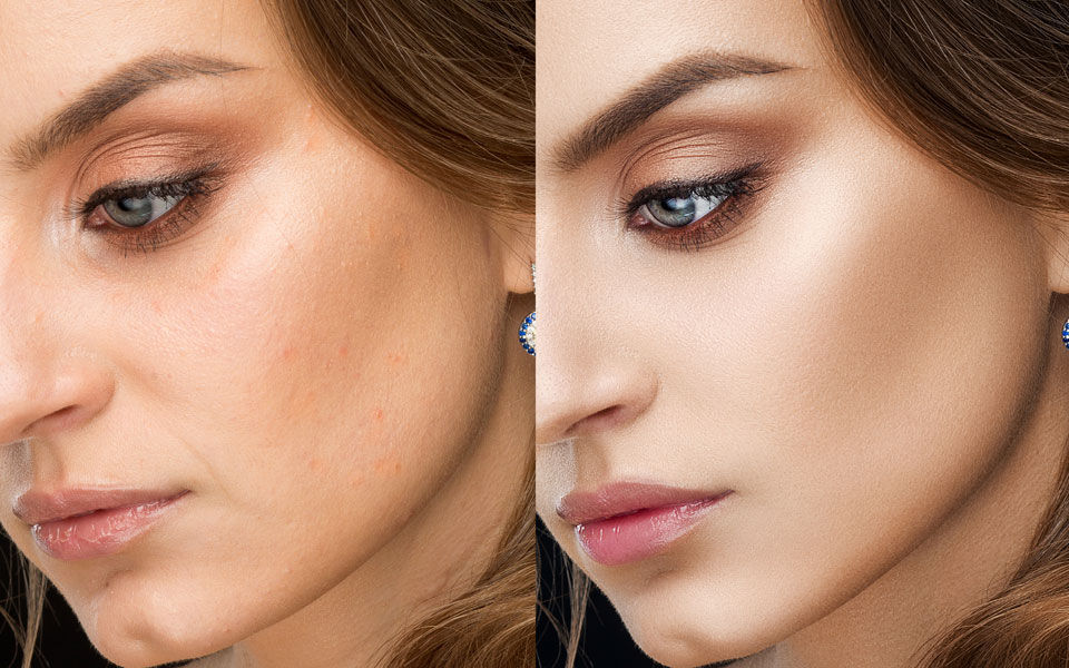 Image retouching